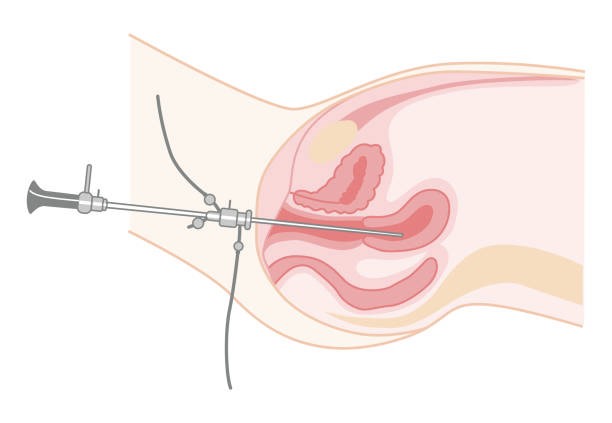 best hysteroscopy specialist surgeon in vile parle andheri